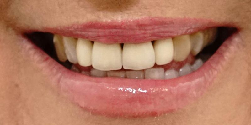 Before_After_Slide_4_Before